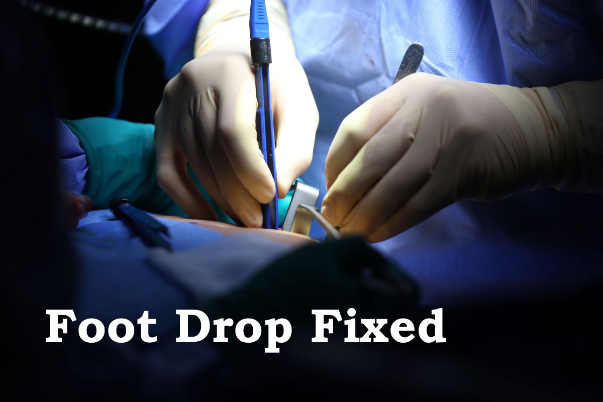 foot-drop-surgically-fixed-by-releasing-common-peroneal-nerve