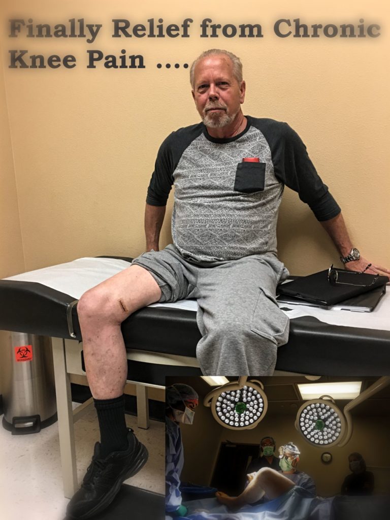 Most people with chronic knee pain due to nerve damage sustain the nerve damage as a complication of knee surgery. But for some patients like Mark the source of their knee pain from the very beginning is damage to sensory nerves around the knee joint. 
