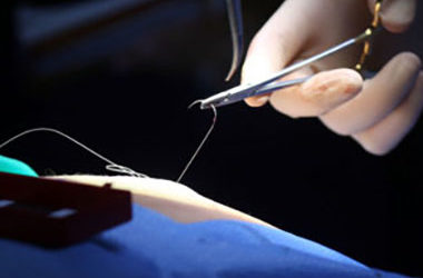 The Difference Between Peripheral Nerve Surgery and Pain Management