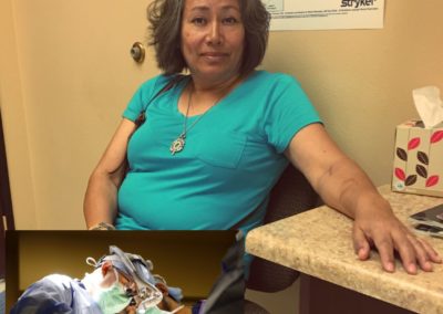 Carpal Tunnel Release and Denervation Surgery Help Patient Regain Use of Her Dominant Hand