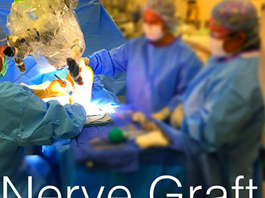 Nerve Graft Offers Solution for Patient with Peripheral Nerve Damage