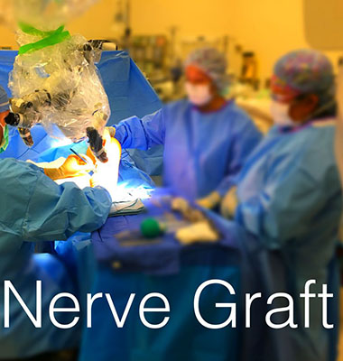 Nerve Graft Offers Solution for Patient with Peripheral Nerve Damage
