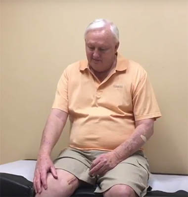 Denervation Surgery Helps Knee Pain After Knee Arthoplasty