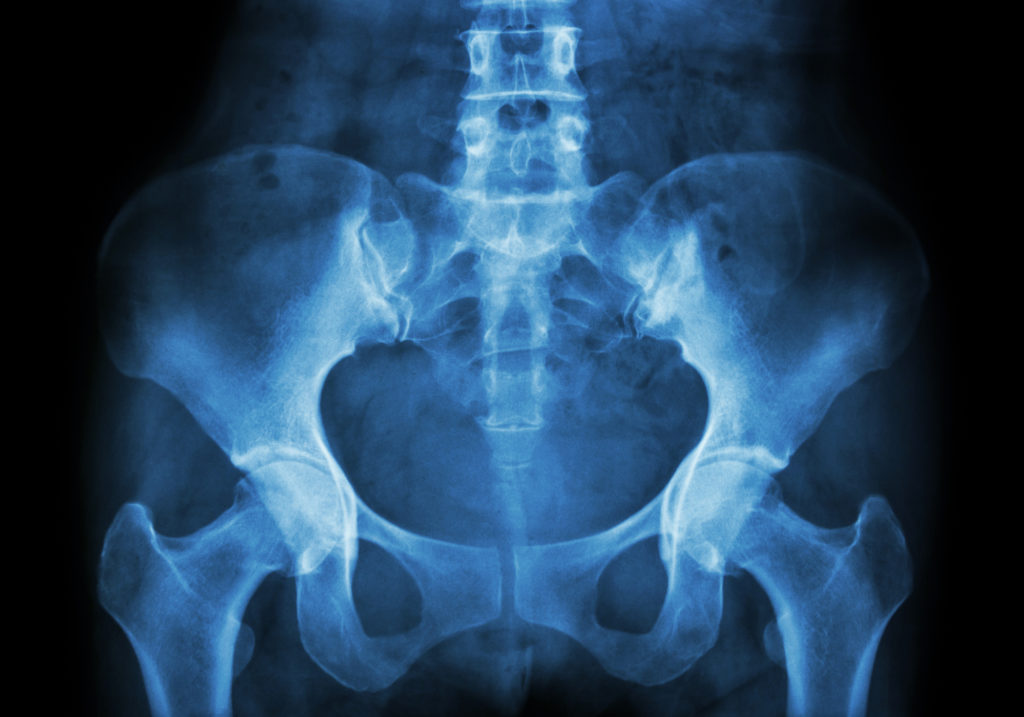 chronic-pelvic-pain-treatment-tim-tollestrup-md