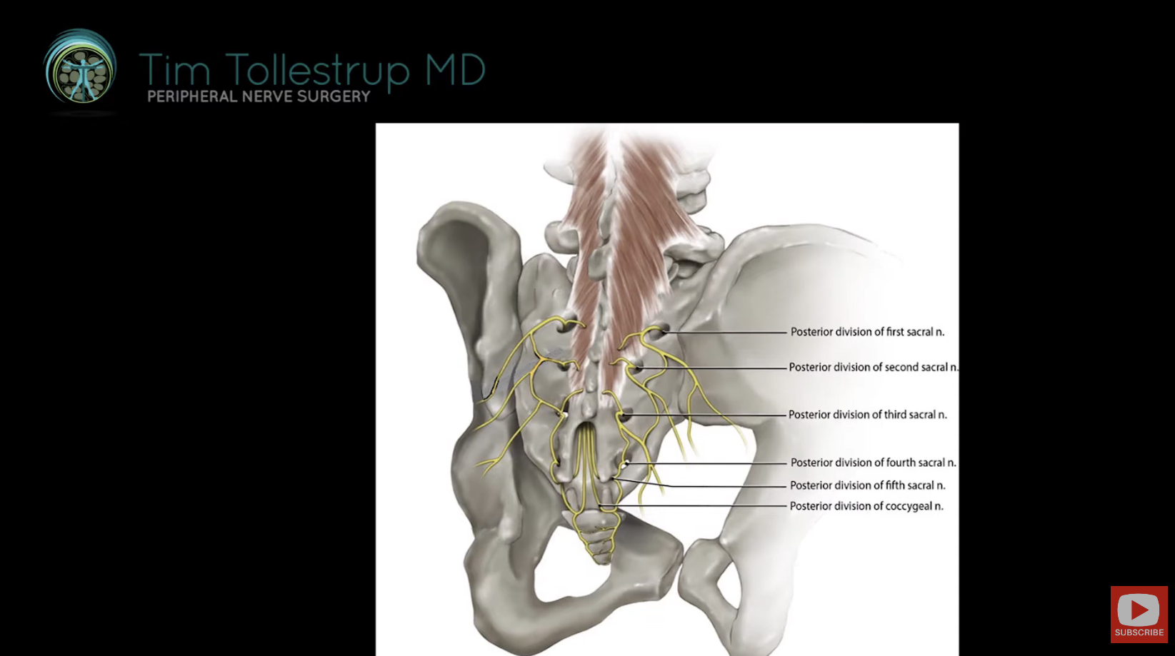 Middle Cluneal Nerves and Coccydynia - Dr. Tim Tollestrup
