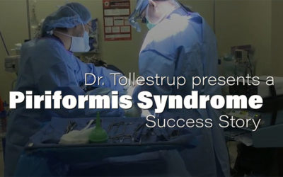 Piriformis Syndrome Pain Gone with Nerve Surgery – Denise’s Success Story