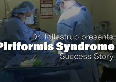 Piriformis Syndrome Pain Gone with Nerve Surgery – Denise’s Success Story