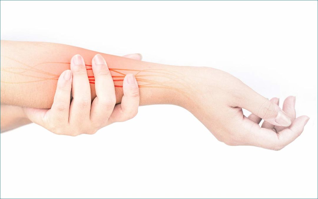 You May Need Pronator Syndrome Surgery for Your Elbow Pain