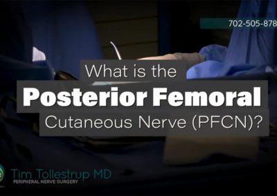 Pain from Damage to the Posterior Femoral Cutaneous Nerve