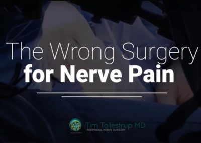Why Not To See an Orthopedic Surgeon for Nerve Pain