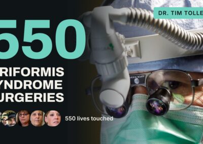 Piriformis Syndrome Surgery: 550 Patients, 550 Stories